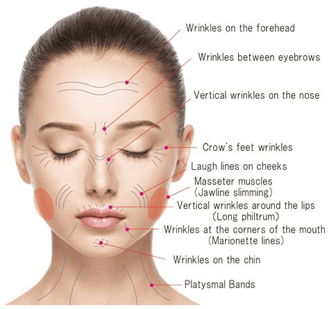 Botulinum toxin treatment 肌のクリニック高円寺院麹町院 医療脱毛 ニキビ AGA シミ治療