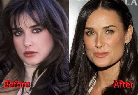 Demi Moore Plastic Surgery Gone Too Far