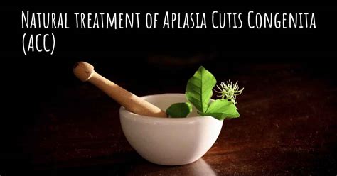 Is There Any Natural Treatment For Aplasia Cutis Congenita Acc