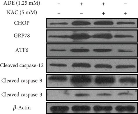 Effect Of Nac On Ers And Apoptosis A Nac Markedly Improved Ht