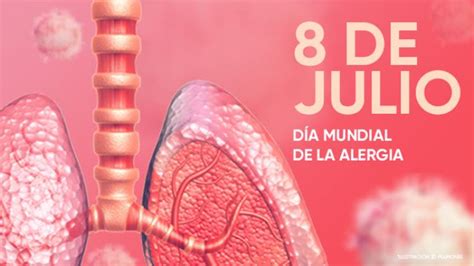 Día Mundial De La Alergia Meridiano63