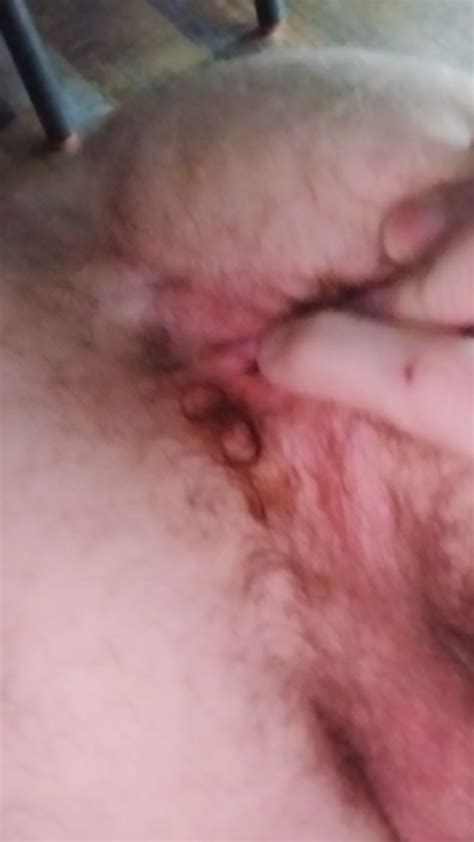 Who To Eat My Dirty Ass ThisVid