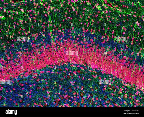 Hippocampus tissue. Light micrograph of a sagittal (side view) section ... 