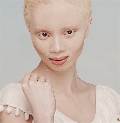 Thando Hopa Albino Model Albinism Interesting Faces