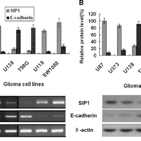 Effect Of Sip1 Knockdown Or Overexpression On Glioma Cell Migration In