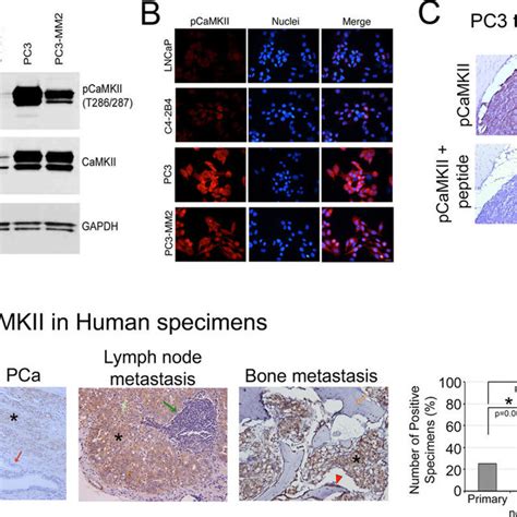 PCaMKII Expression In Prostate Cancer Cell Lines And Human Prostate