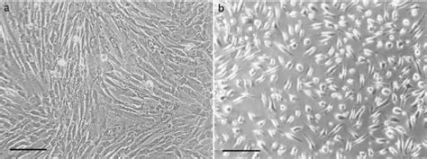 Human Mesenchymal Stem Cells From Umbilical Cord Tissue 3 Days After Download Scientific