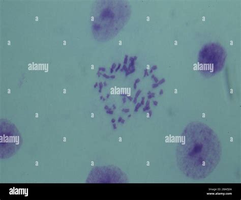 Conjunto De Cromosomas Humanos Fotograf As E Im Genes De Alta