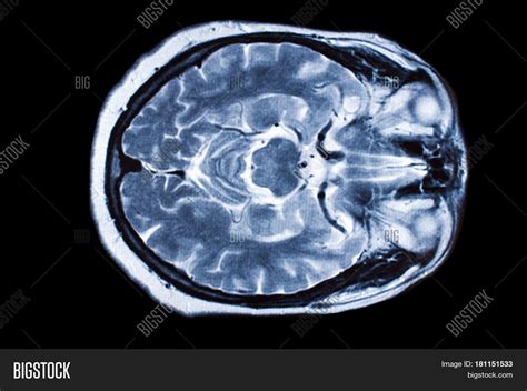 X Ray Image Brain Image And Photo Free Trial Bigstock