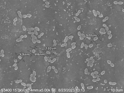 The scanning electron microscope image of Lactococcus sp.... | Download ...