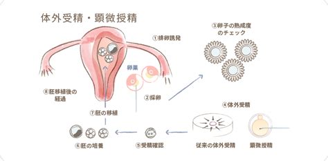 高度生殖医療｜吉澤レディースクリニック