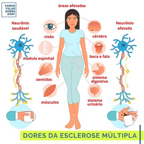 Dores da esclerose múltipla