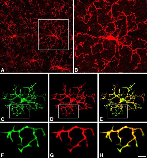 Morphological Properties Microglial Cells In Hamsters At The Arousal