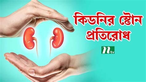 কিডনির স্টোন প্রতিরোধে কী করণীয় Health Show স্বাস্থ্য প্রতিদিন