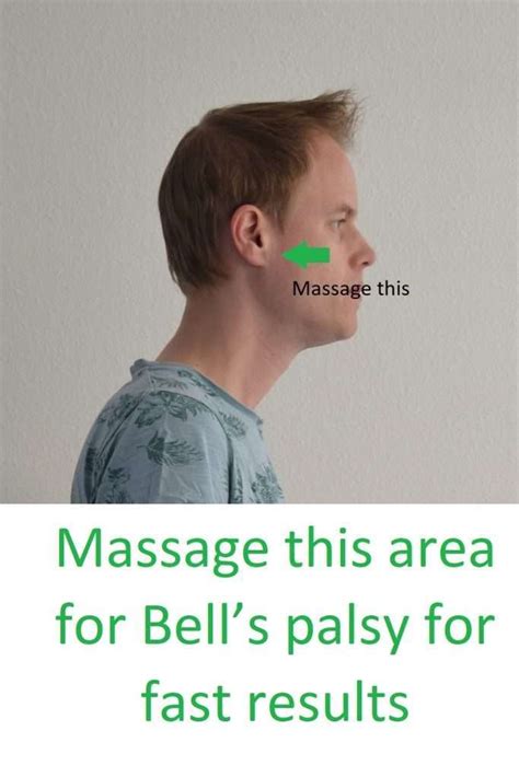 Bells Palsy Cause Symptoms And Treatment With Massage