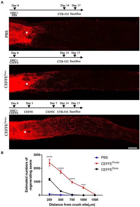 Frontiers Cell Free Fat Extract Promotes Axon Regeneration And