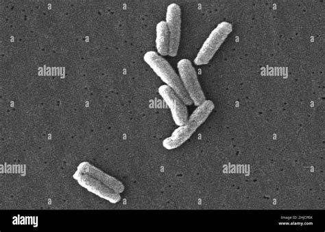 Scanning Electron Micrograph Sem Of A Number Of Gram Negative Legionella Pneumophila Bacteria