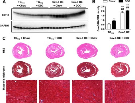 Protective Role Of Cardiac Specific Overexpression Of Caveolin 3 In