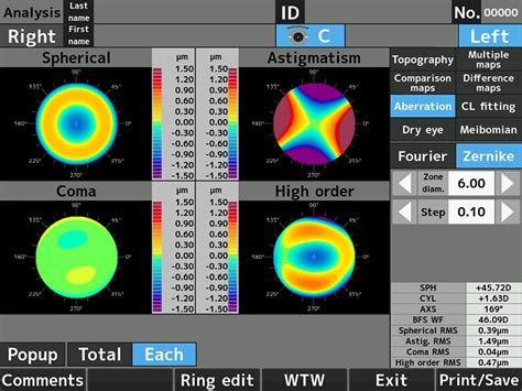 Auto Ref Topographer RET 700 Rexxam Quality In Vision Care