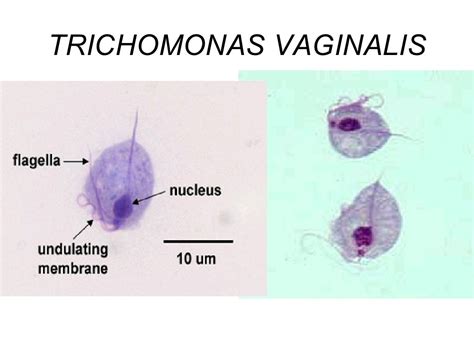 Toxoplasma Gondii