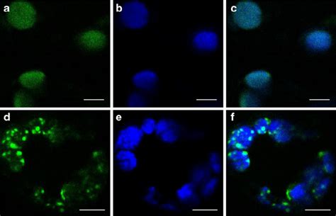 Transient Expression Of Crtrb Gfp And Psy Gfp Fusion Proteins In