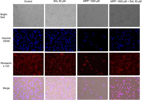 SH-SY5Y neuroblastoma cells exposed for 48 h to 50 μM SAL, 1000 μM MPP ...