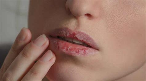 ¿por Qué Se Resecan Los Labios Mejor Con Salud