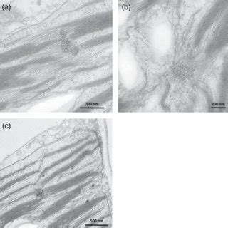 Transmission Electron Microscope Micrographs Illustrating The