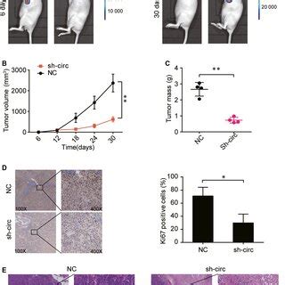 Silencing Circ Inhibited The Tumorigenesis Of Crc Cells In