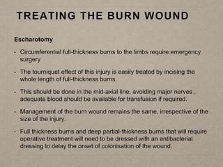 Management Of Burn | PPT