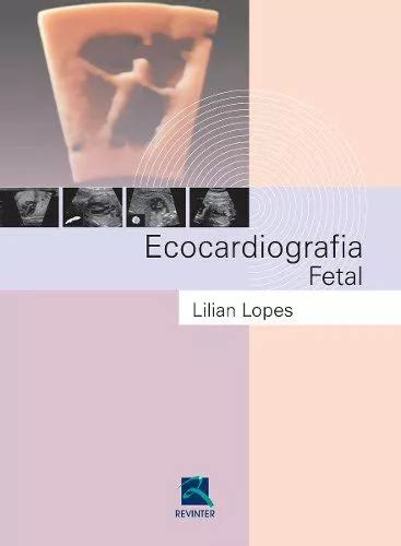 Ecocardiografia Fetal Parcelamento Sem Juros