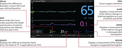 Masimo Cerebral Oximetry