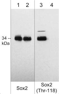 Sox2 Phospho Methyl Specific Antibody Kit ECM Biosciences