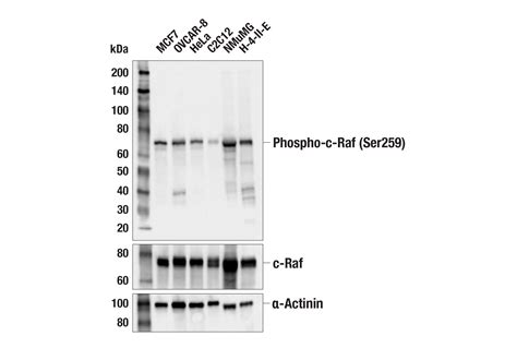 Phospho C Raf Ser259 E7Z7H Rabbit MAb Cell Signaling Technology