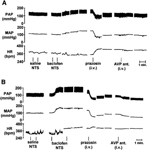 Effects Of Bilateral Microinjection Of 100 Pmol 100 Nl A And 1 000 Download Scientific