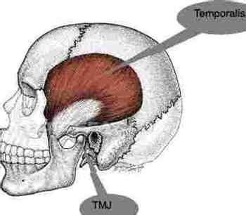 What causes headache is a question oft heard in the chiropractic clinic.