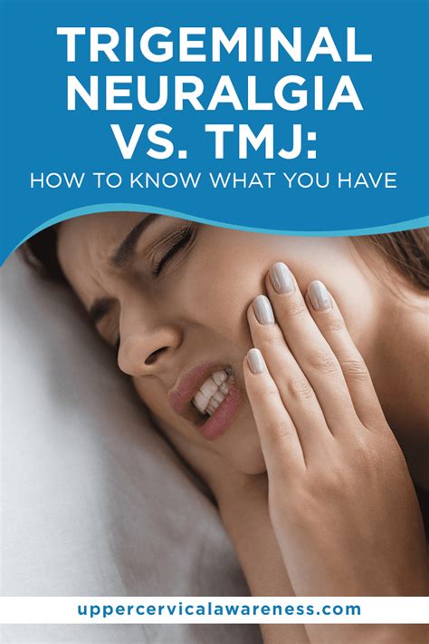 Trigeminal Neuralgia Vs Tmj How To Know What You Have Artofit