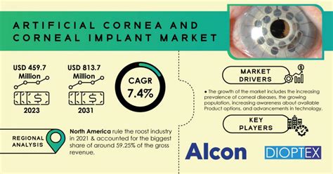 Artificial Cornea and Corneal Implant Market Poised to Reach USD 813.7 ...