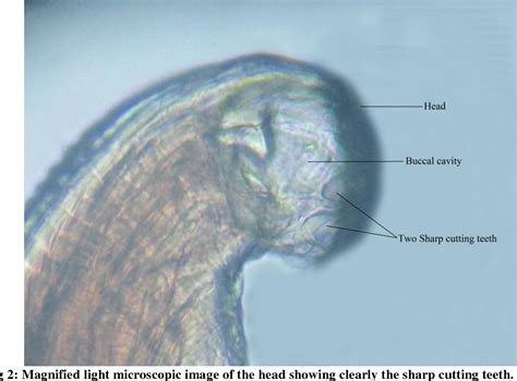 Figure 2 From An Extremely Rare Report Of Various Light Microscopic