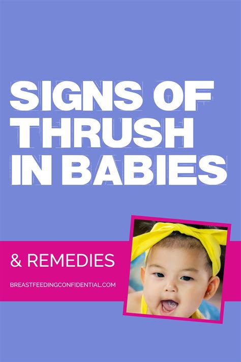 Newborn Thrush Symptoms Signs