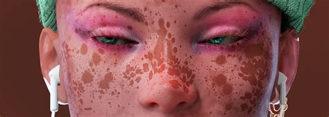 VITILIGO MODELS on Behance