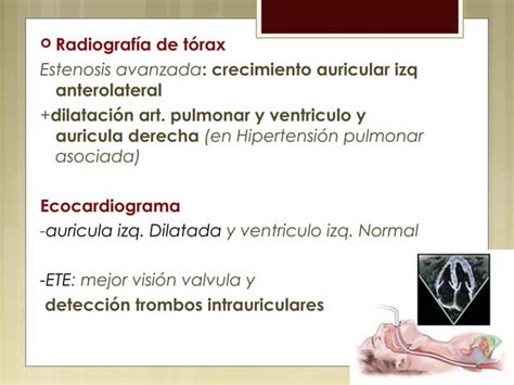 Valvulopat A Mitral Y Tric Spide Ppt