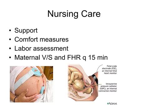 4 Stages Of Labor Ppt