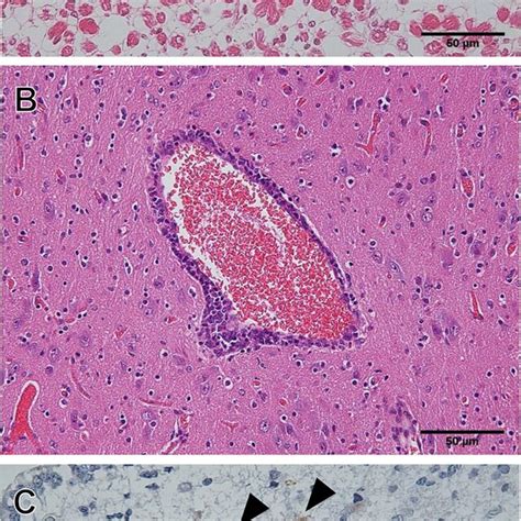 Microscopic Observation Of Gross Lesions And The Viral Antigen