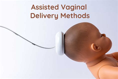 Vacuum Assisted Delivery Guidelines At Lorene Cynthia Blog