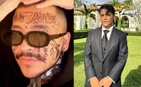 Christian Nodal Y El Costoso Tratamiento Millonario Para Quitar Los