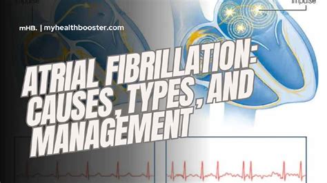 Atrial Fibrillation: Causes, Types, and Management – MyHealthBooster