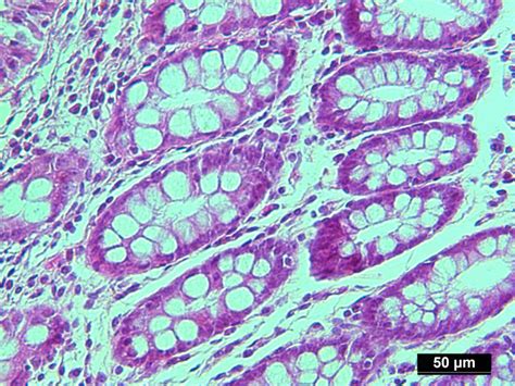 Pure Human Normal Colon Gland Epithelium Isolated By Lcm From Ffpe Sample