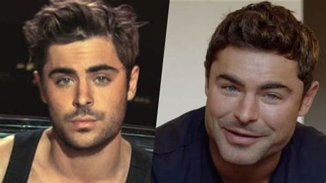 Zac Efron E La Chirurgia Lattore Spiega Come Mai è Cambiato Il Suo Volto