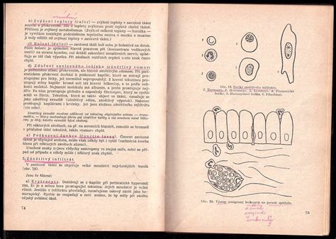 Pathologick Anatomie A Fysiologie U Ebn Text Pro Zdravot Koly